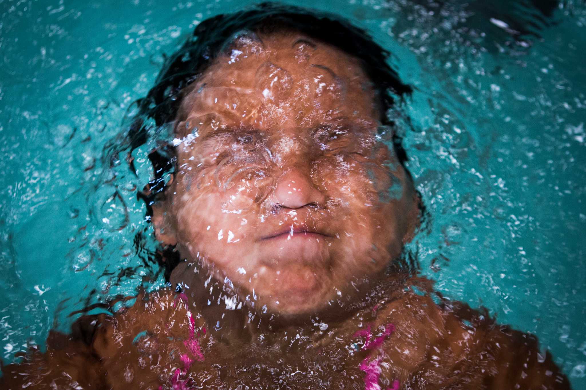 chết đuối sống lại